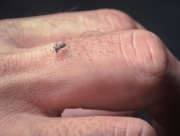 Close up picadas de mosquito que comem sangue os dedos do homem causar propagação da doença.