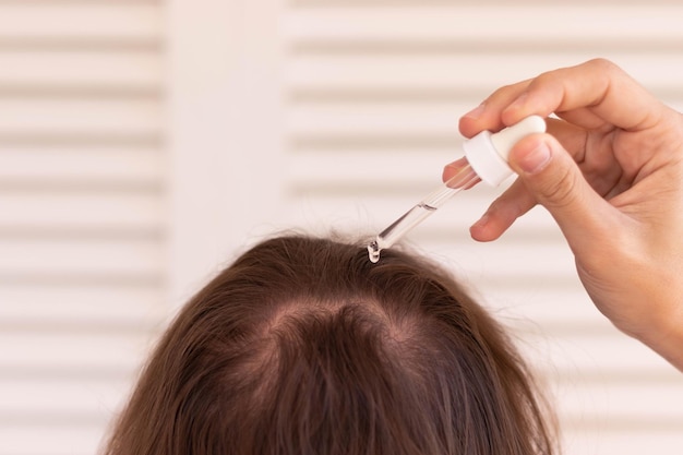 Close-up vista de um jovem irreconhecível com cabelos longos, colocando loção de crescimento de cabelo com uma pipeta na cabeça