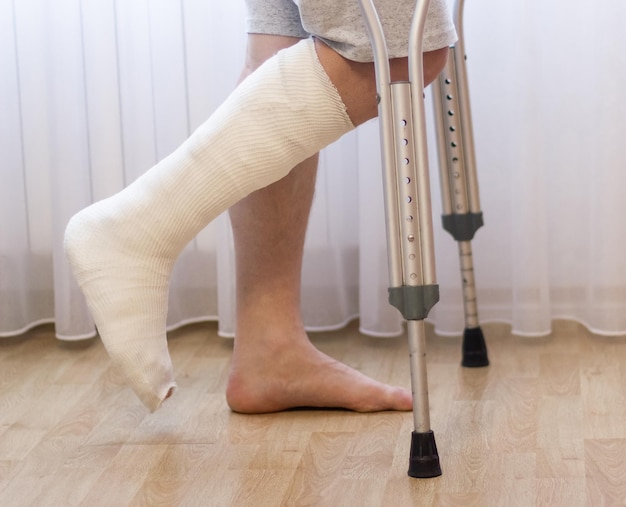 Closeup da perna do homem em gesso usando muletas enquanto caminhava