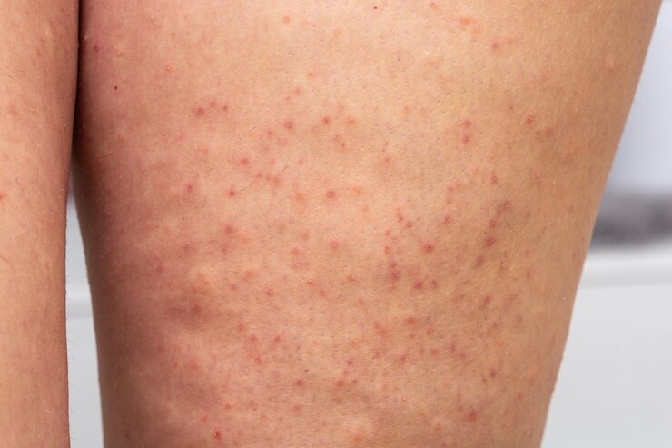 Foto closeup das pernas da mulher com queratose pilar