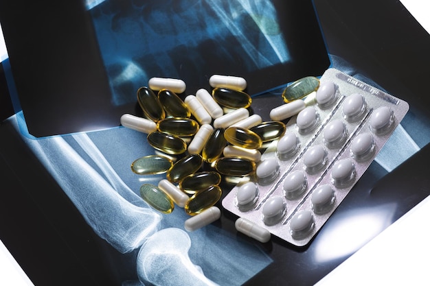 Closeup de cápsulas de óleo de peixe de imagem de raio X e pílulas brancas Suplementos dietéticos e drogas