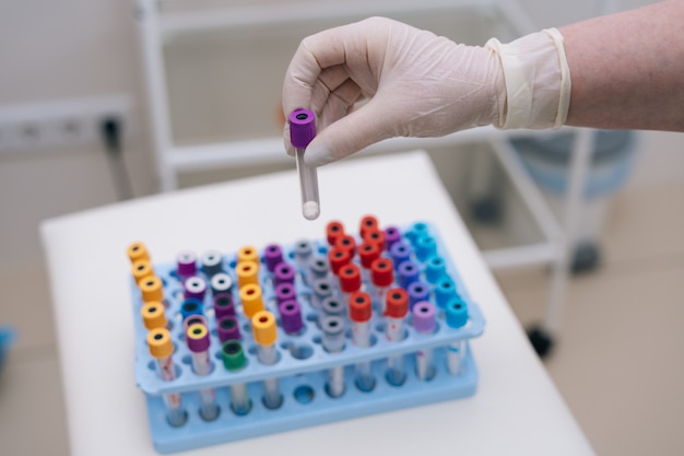 Closeup de médico usando luva médica tirando tubos para exame de sangue