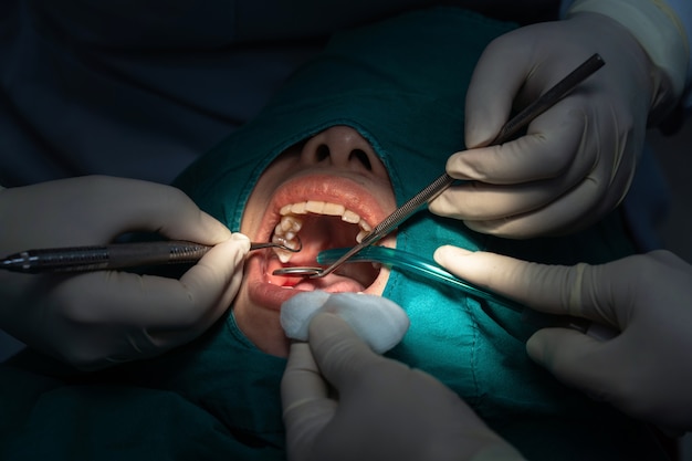 Closeup, dentista e assistente operando para verificação e limpeza dos dentes na clínica odontológica