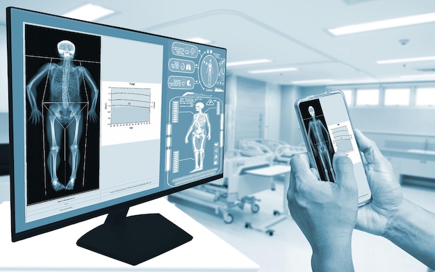 Closeup Doctor usa un teléfono inteligente para verificar una imagen de una exploración de densidad ósea DXA en un monitor en una mujer para prevenir la osteoporosis en el fondo de la habitación borrosa Concepto de tecnología médica