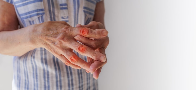 Foto closeup uma velha faz-se uma artrose de artrite de massagem manual