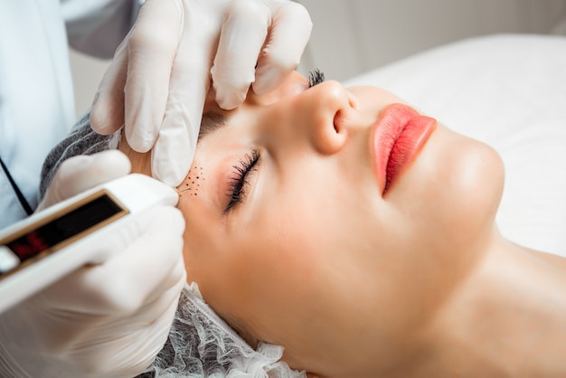 Coagulador de plasma para rejuvenecimiento facial, estiramiento y suavizado de arrugas faciales. Hermosa mujer joven en un salón de belleza.