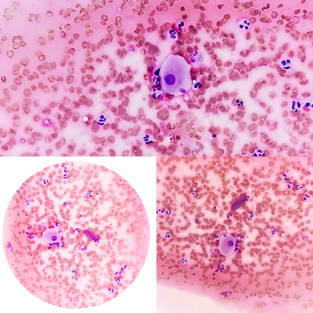 Foto colegio de tres imágenes microscópicas que muestran cambios inducidos por radiación. frotis de bóveda.