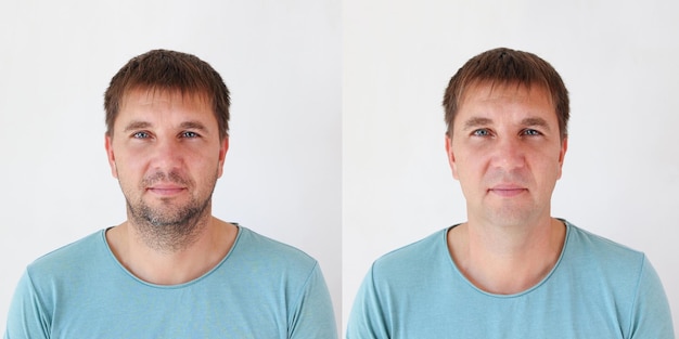 Foto collage eines mannes vor und nach der rasur sein gesicht ist unrasiert und ohne bart