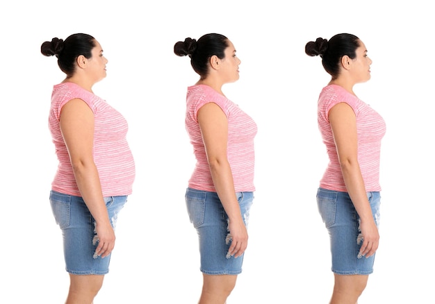 Collage mit Fotos von übergewichtigen Frauen vor und nach der Gewichtsabnahme auf weißem Hintergrund Bannerdesign