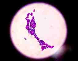 Foto colonia de candida bajo visión microscópica o infección por hongos candida albicans