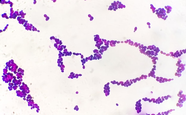 Foto colonia de candida bajo visión microscópica o infección por hongos candida albicans