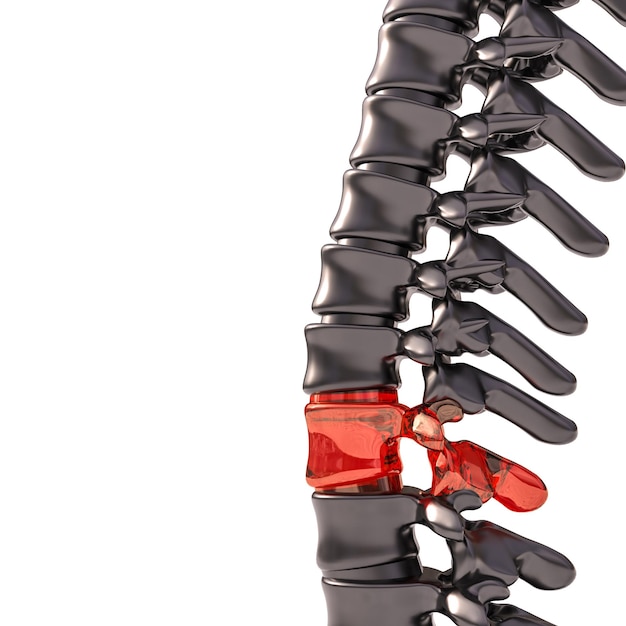 Coluna vertebral com vértebras de vidro. conceito de fragilidade. 3d render