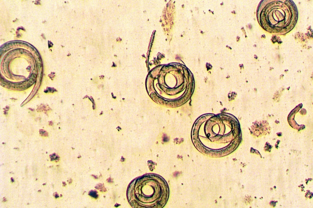 Comprender la prevención y el tratamiento de las infecciones por triquinelosis.