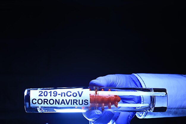 conceito coronavírus 2019-ncov, teste de risco biológico in vitro de vírus