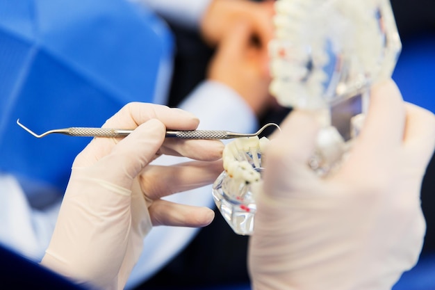 Foto conceito de pessoas, medicina, estomatologia e cuidados de saúde - close-up das mãos do dentista com layout de mandíbula ou dentes e sonda dentária no consultório da clínica odontológica