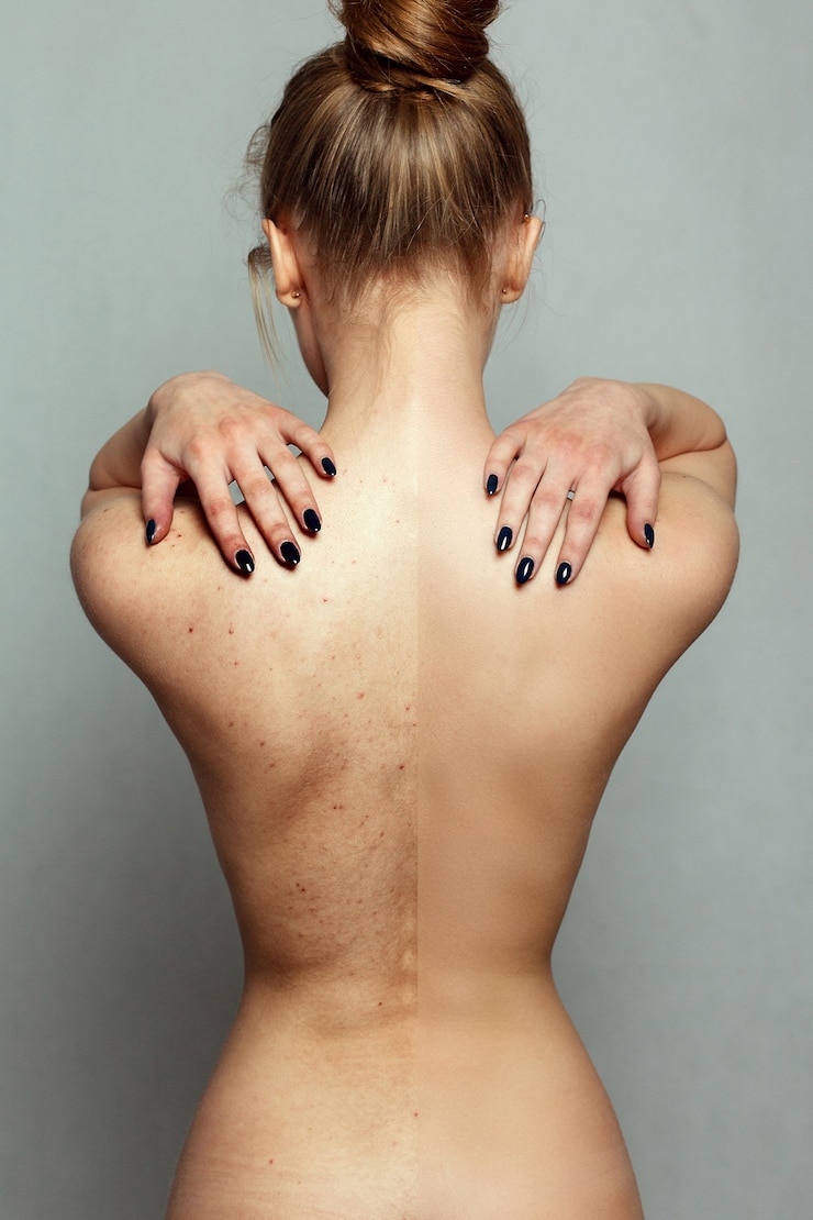 Foto conceito de pessoas, saúde e estilo de vida - retrato de uma jovem bonita. antes e depois de procedimentos cosméticos ou plásticos, operação, terapia anti-envelhecimento. closeup de corpo feminino e mãos no peito