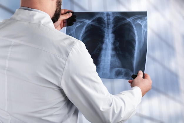 conceito de radiografia pulmonar. médico de radiologia examinando em