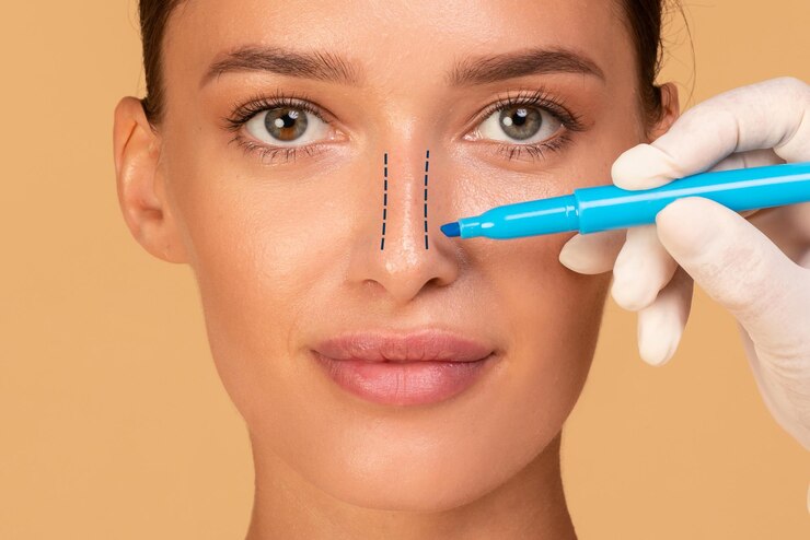 Foto conceito de rinoplastia jovem mulher com marcação no nariz no fundo do estúdio bege closeup