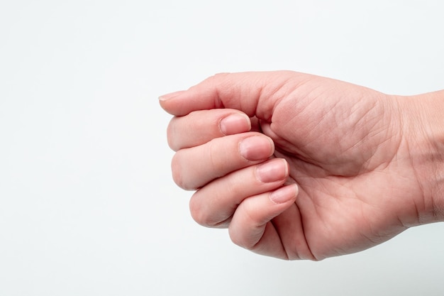 Conceito de unhas naturais, unhas cruas. Close de uma mão feminina branca com unhas naturais não polidas e cutícula crescida