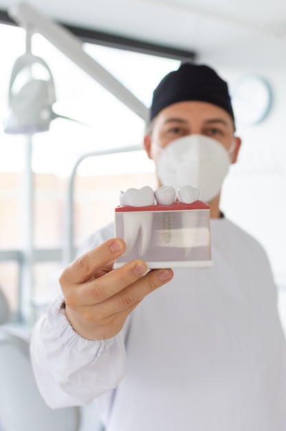 Concéntrese en la mano de un dentista sosteniendo un modelo de implante dental mientras su rostro está desenfocado en el fondo Enfoque selectivo