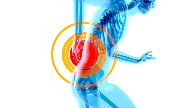 Concepto de anatomía 4K de un dolor de espalda