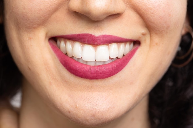 Concepto de cuidado dental de salud bucal de dientes blancos perfectos de mujer joven