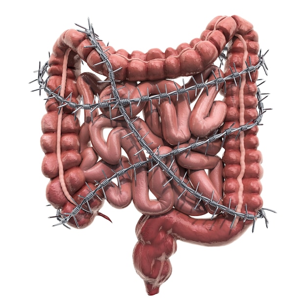 Foto concepto de dolor abdominal intestino humano con renderizado 3d de alambre de púas