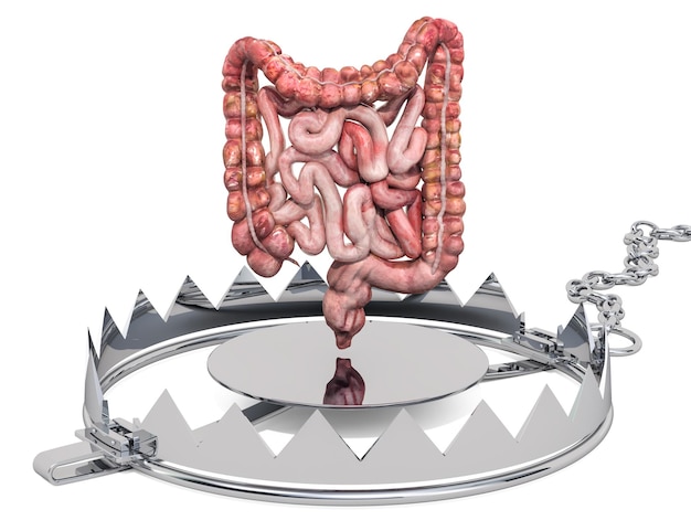 Concepto de dolor abdominal Intestinos humanos dentro de la representación 3D de la trampa para osos