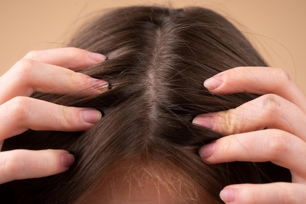 Concepto de pérdida de cabello Pérdida de cabello de cerca Cabello enredado Problema