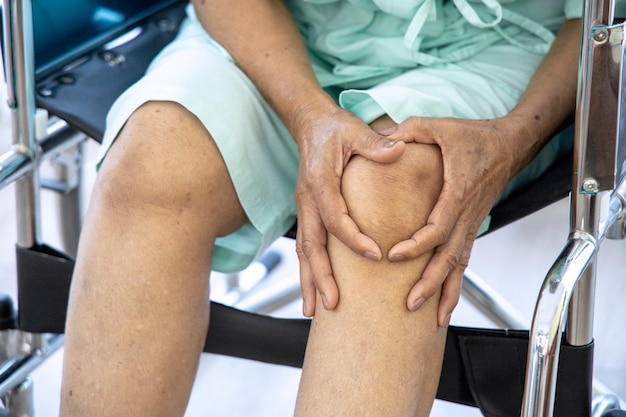 Foto concepto de problema de salud; anciana que sufre de dolor de rodilla en el hospital.