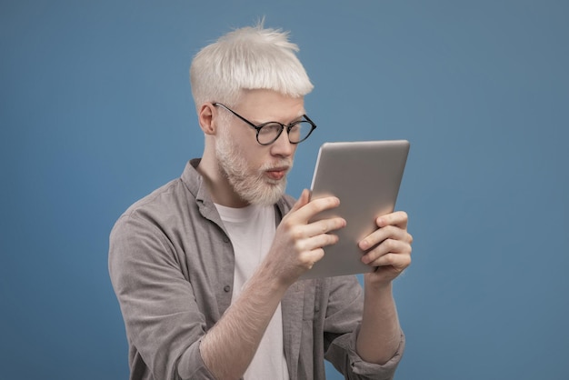 Concepto de problemas de visión hombre albino en anteojos mirando la pantalla de la tableta y frunciendo el ceño sufriendo