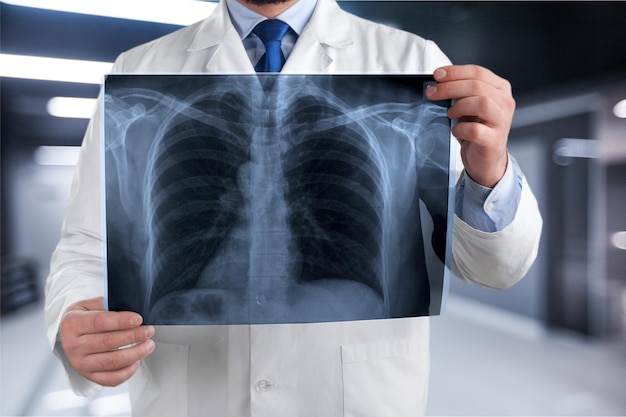 concepto de radiografía pulmonar.