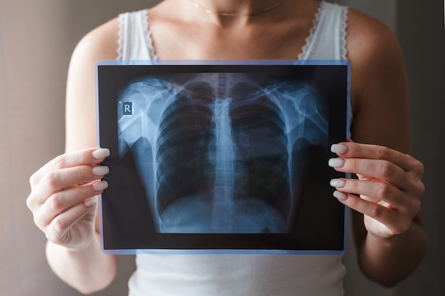 Concepto de radiografía pulmonar.