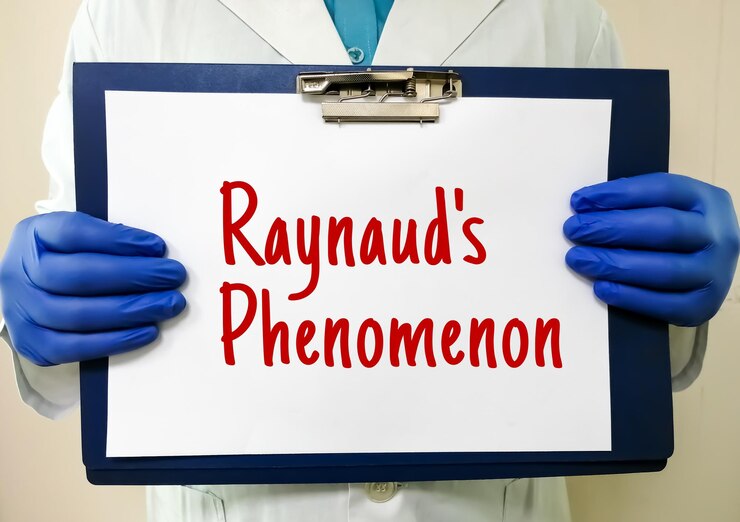Foto concepto de salud del fenómeno de raynaud imagen conceptual médica