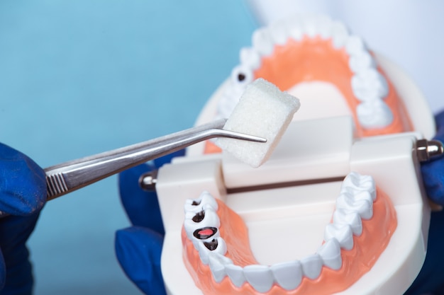 Consulta de dentista, instrumentos de odontologia e conceito de check-up higienista dental com dentaduras modelo de dentes e instrumentos de estomatologia em cinza escuro. Exames regulares são essenciais para a saúde bucal