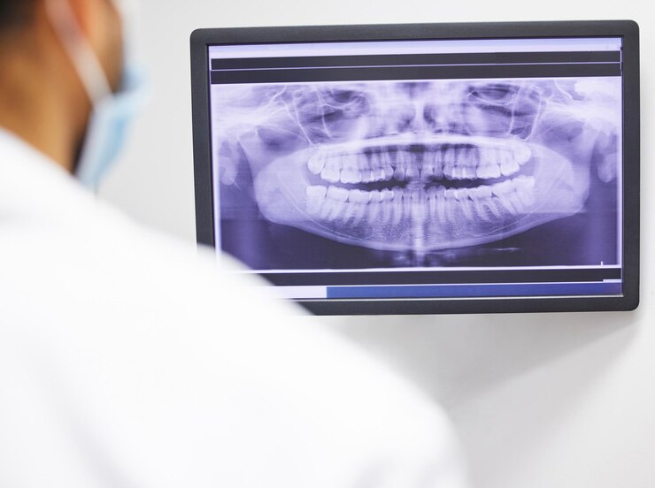 Foto consulta dentária e raio-x dos dentes no ecrã para educação anatômica diagnóstico dental e planeamento de tratamento avaliação oral pessoa e monitor com imagem para higiene saúde e bem-estar