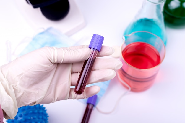 Coronavirus 2019-nCoV concept bodegón con análisis de sangre, medicamentos y frascos de laboratorio. COVID-19