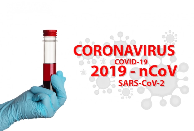 Coronavírus (COVID-19. Análise de sangue do laboratório em uma garrafa na parede branca. SARS-CoV-2