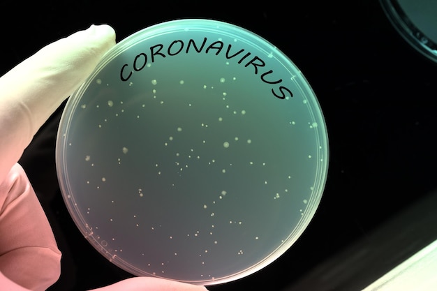 Coronavirus en una placa de Petri imagen conceptual de análisis de laboratorio y riesgo de contagio