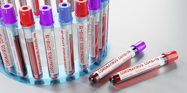Coronavirus SARS CoV 2 Covid 19 Virus Reagenzgläser Bluttests 3D-Illustration