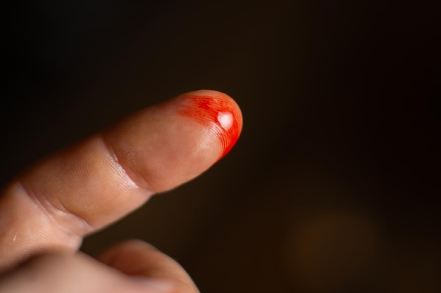 Corte de dedo en la cocina Dedo masculino con herida y sangre