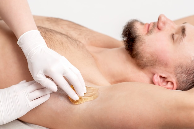 Foto cosmetóloga aplicando pasta de cera en la axila masculina