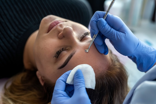 Cosmetóloga con cuchara de instrumento mecánico uno quitando y limpieza de espinillas en la cara de un paciente en un salón de belleza