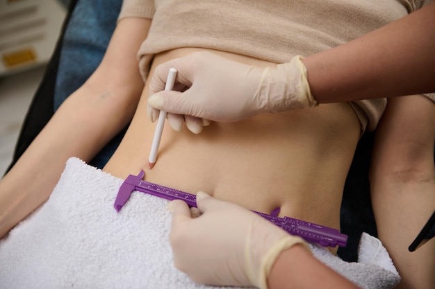 Cosmetologista closeup mede o nível de gordura da barriga com pinça e desenha linhas com lápis branco no abdômen da mulher