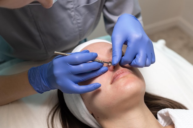 Foto el cosmetólogo elimina las manchas negras y el acné en la piel de la cara de la mujer