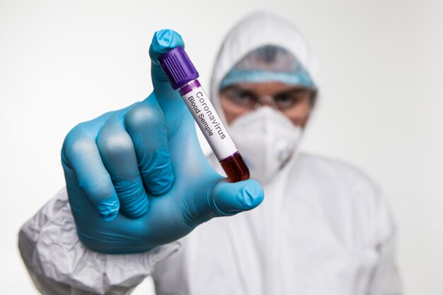 COVID-19-Test und Laborprobe von Blutuntersuchungen zur Diagnose einer neuen Corona-Virus-Infektion. Krankheit 2019 aus Wuhan. Pandemisches infektiöses Konzept