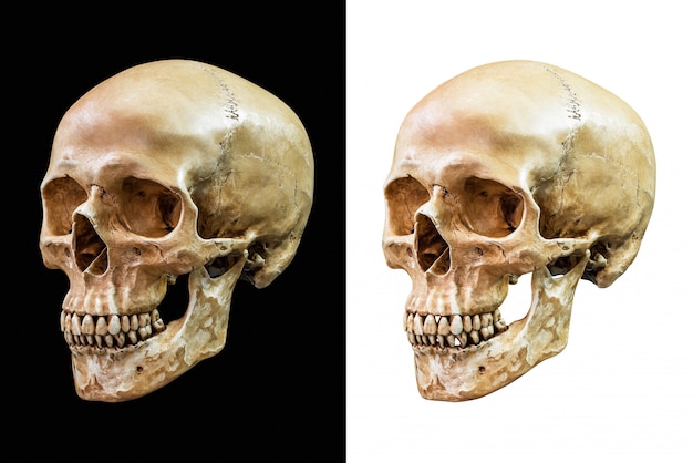 Foto cráneos humanos