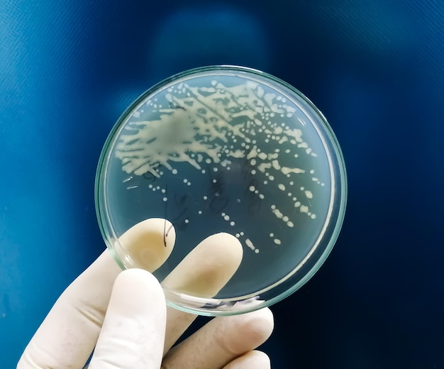 Foto crecimiento de bacterias gram negativas en medio uti agar