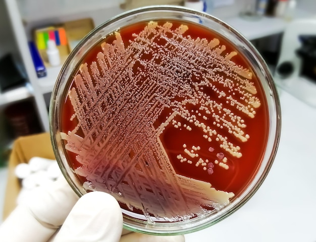 Crecimiento de bacterias Gram positivas o Staphylococcus o Streptococcus en agar sangre