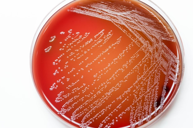 Crecimiento del cultivo bacteriano en agar sangre en microbiología